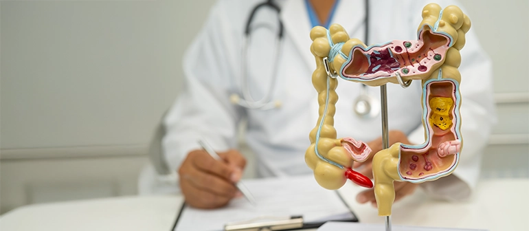 Screening Colon Retto